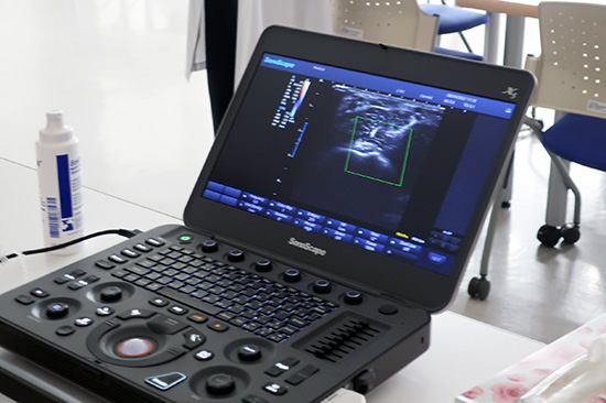  超音波診断装置で動脈の画像を観察